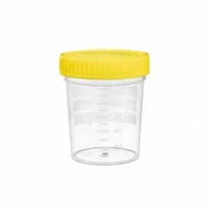 Beaker đa dụng - Greiner Bio One (Đức)